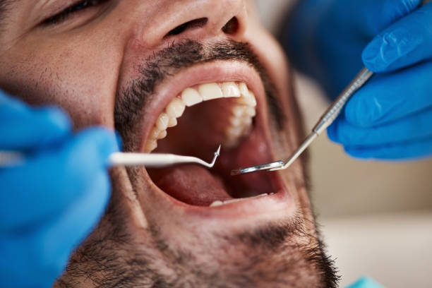 Best Urgent Dental Care for Toothaches in Crossett, AR